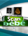 Scan-bb